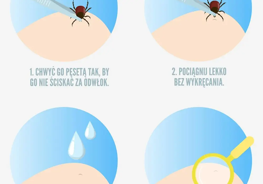 Co zrobić gdy masz kleszcza – bezpieczne usuwanie i dalsze kroki