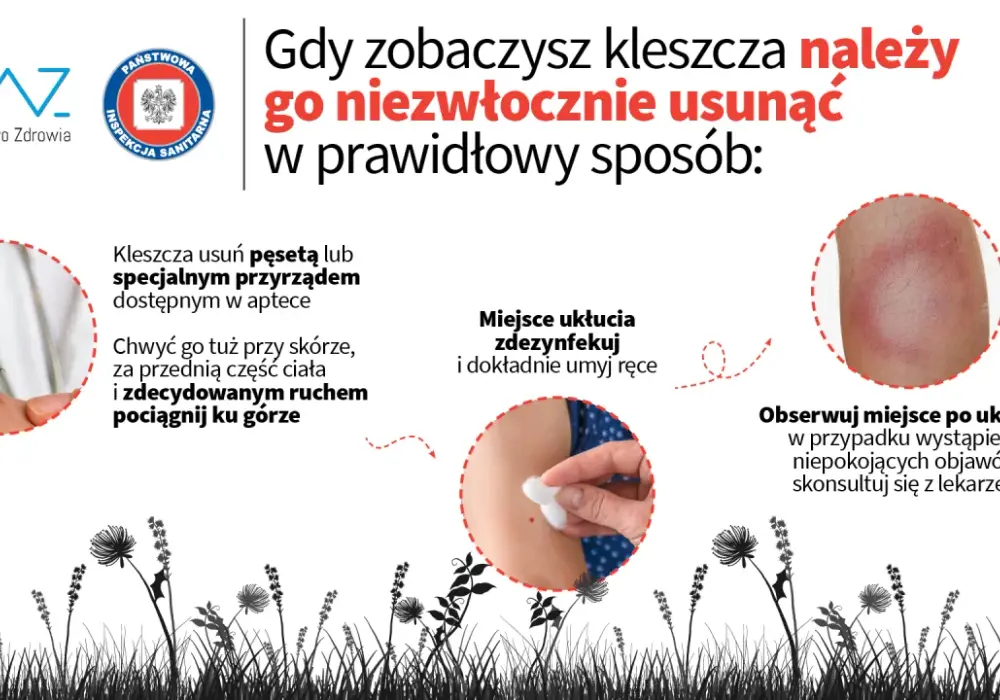 Kleszcz u człowieka – co robić, by uniknąć groźnych chorób i błędów?