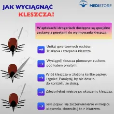 Jak bezpiecznie wyjąć kleszcza kotu i uniknąć groźnych konsekwencji